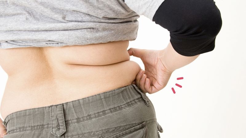 gejala sindrom metabolik